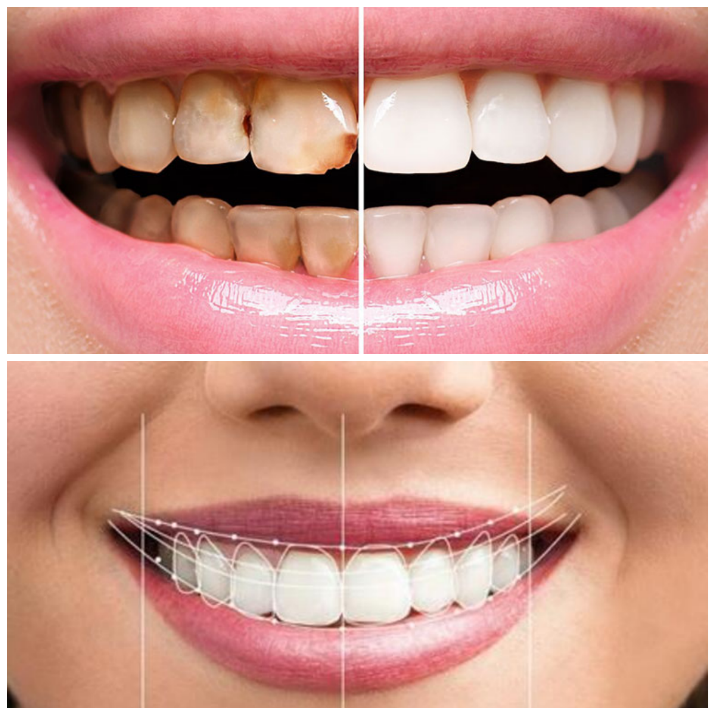 Antalya Estetik Diş Hekimi