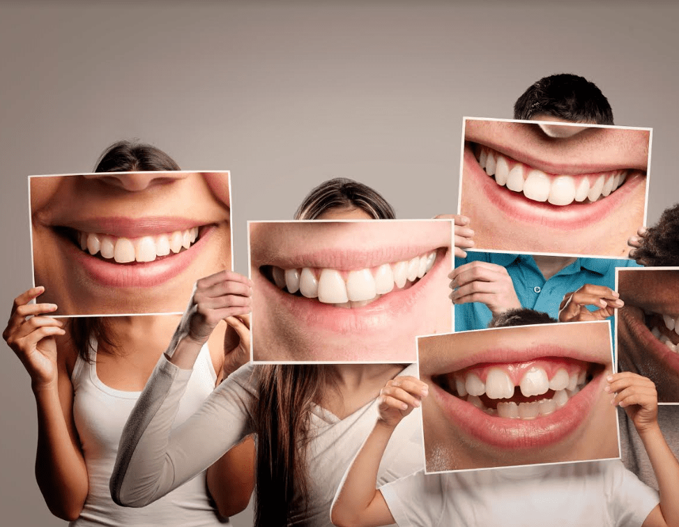 Antalya Diş Tedavisi